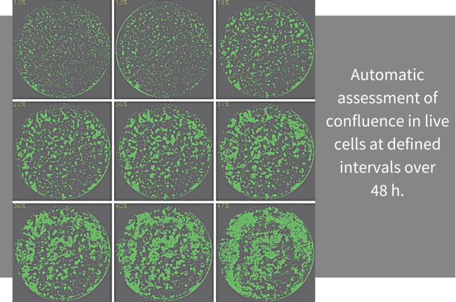 automatic assessment of confluence in live cells