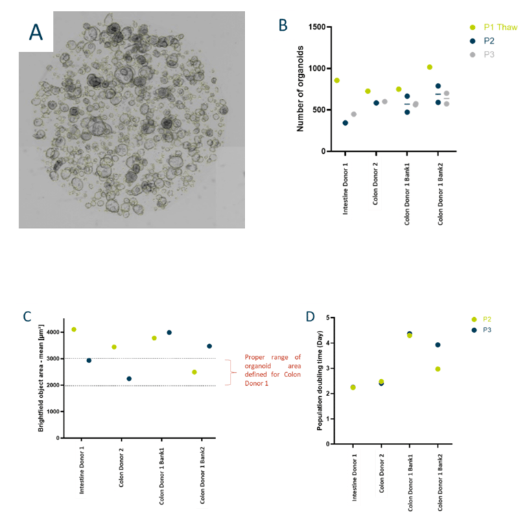 2025-01_a06_Improving_organoid reproducibility_through_real-time_imaging-img3