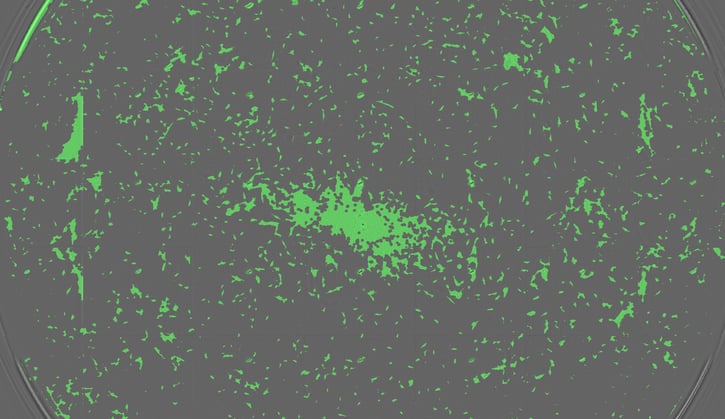 Typical growth of fibroblasts.jpg