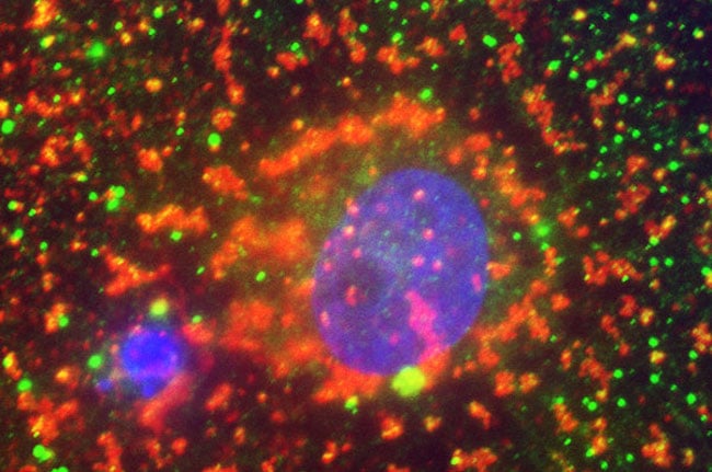 high-sensitivity troponin assays - This image shows a cardiomyocyte (cardiac troponin T, green; sarcomeric α-actin, red; DAPI-stained nucleus, blue). 