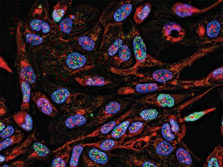 Live cell imaging: how to gain more control