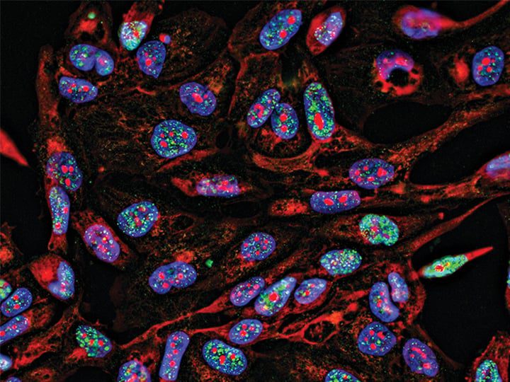 Live cell imaging: how to gain more control
