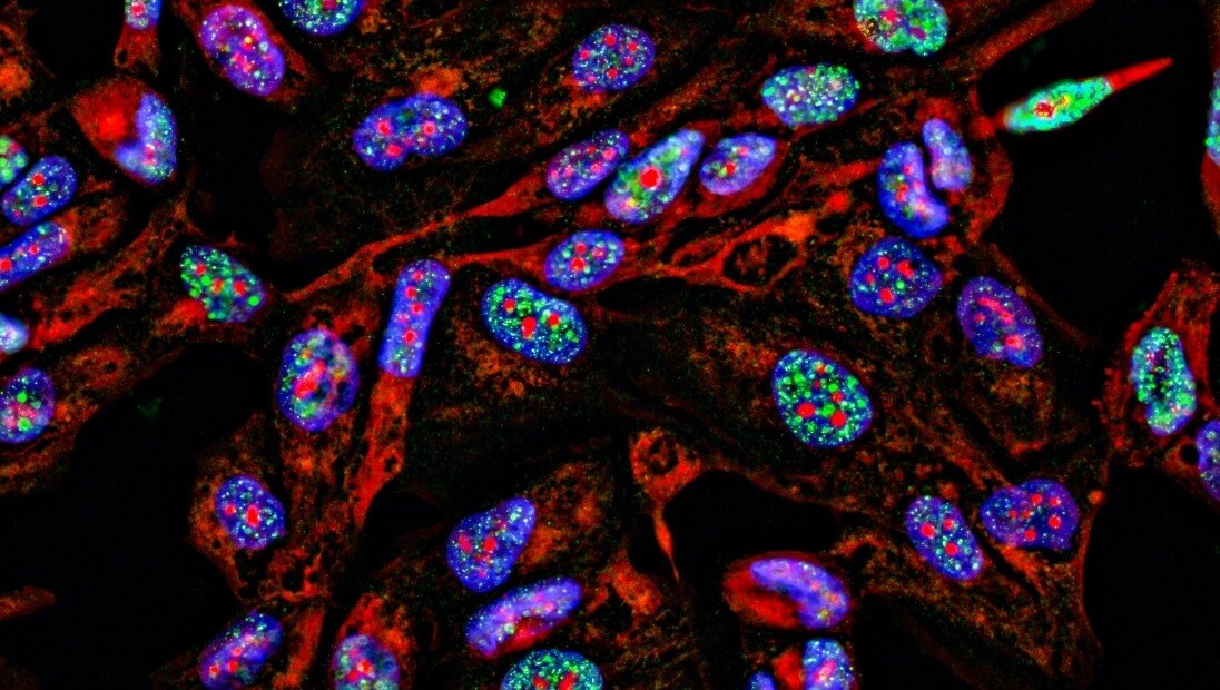 Automating spatial biology workflows: From complexity to reality - The ...
