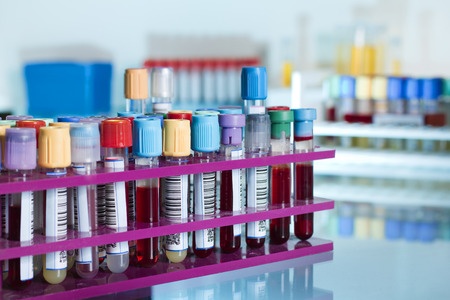 How automated test tube barcoding adds reliability and stops unnecessary errors 4942809973