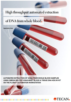High throughput automated extraction of DNA extraction from whole blood