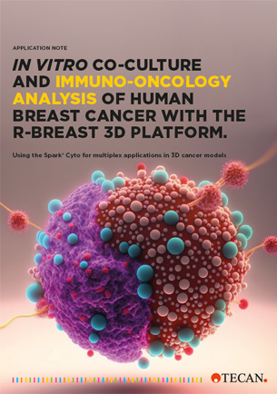 In vitro co-culture and immuno-oncology analysis of human breast cancer with the r-Breast 3D platform