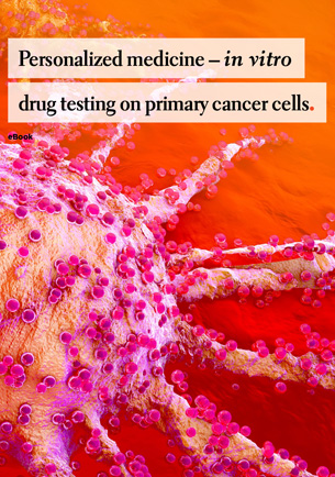 Personalized medicine - in vitro drug testing on primary cancer cells