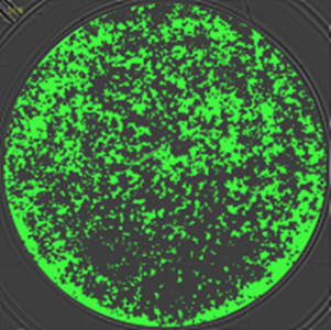 Master the challenges of cell-based fluorescence assays 5821174044