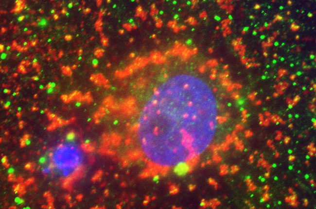 The heart of the matter: finding the 99th percentile for high-sensitivity troponin assays 5659880556