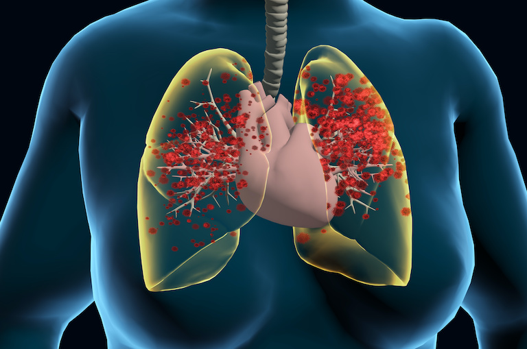 How to measure alarmin HMGB1 in SARS-CoV-2 immune response 38679078157